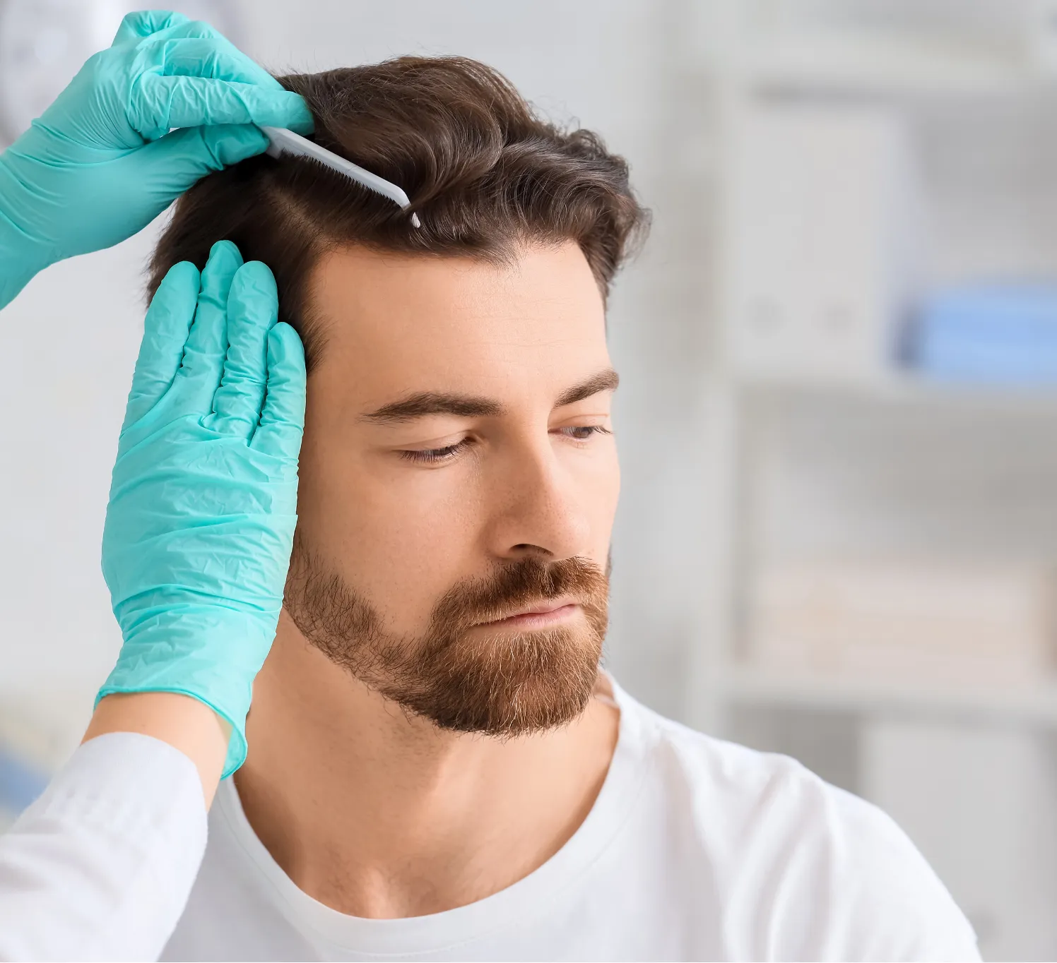 Gloved hands examine a man's scalp and hairline, likely during a hair or skin consultation.